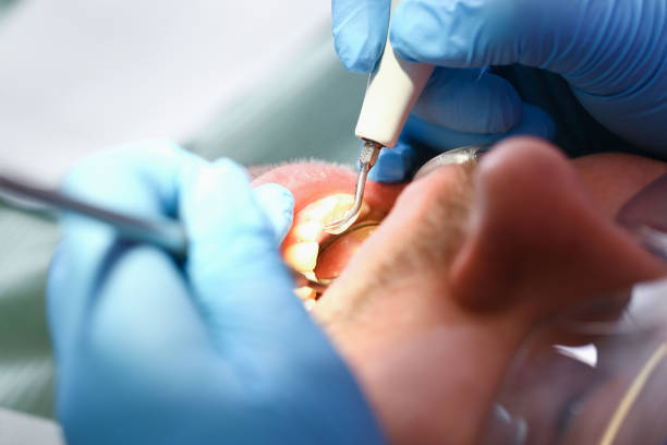 Best Emergency Treatment for Dental Infections or Abscesses in Kodi Station, AK