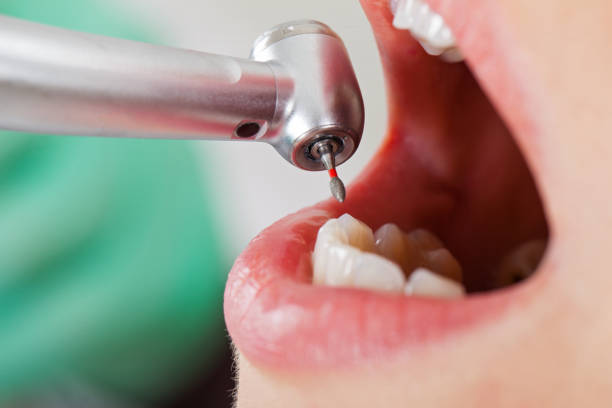 Best Emergency Root Canal Treatment in Kodi Station, AK